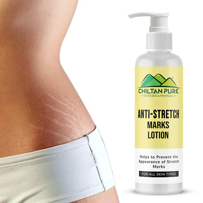 Anti-Stretch Marks Lotion - Chiltan Pure