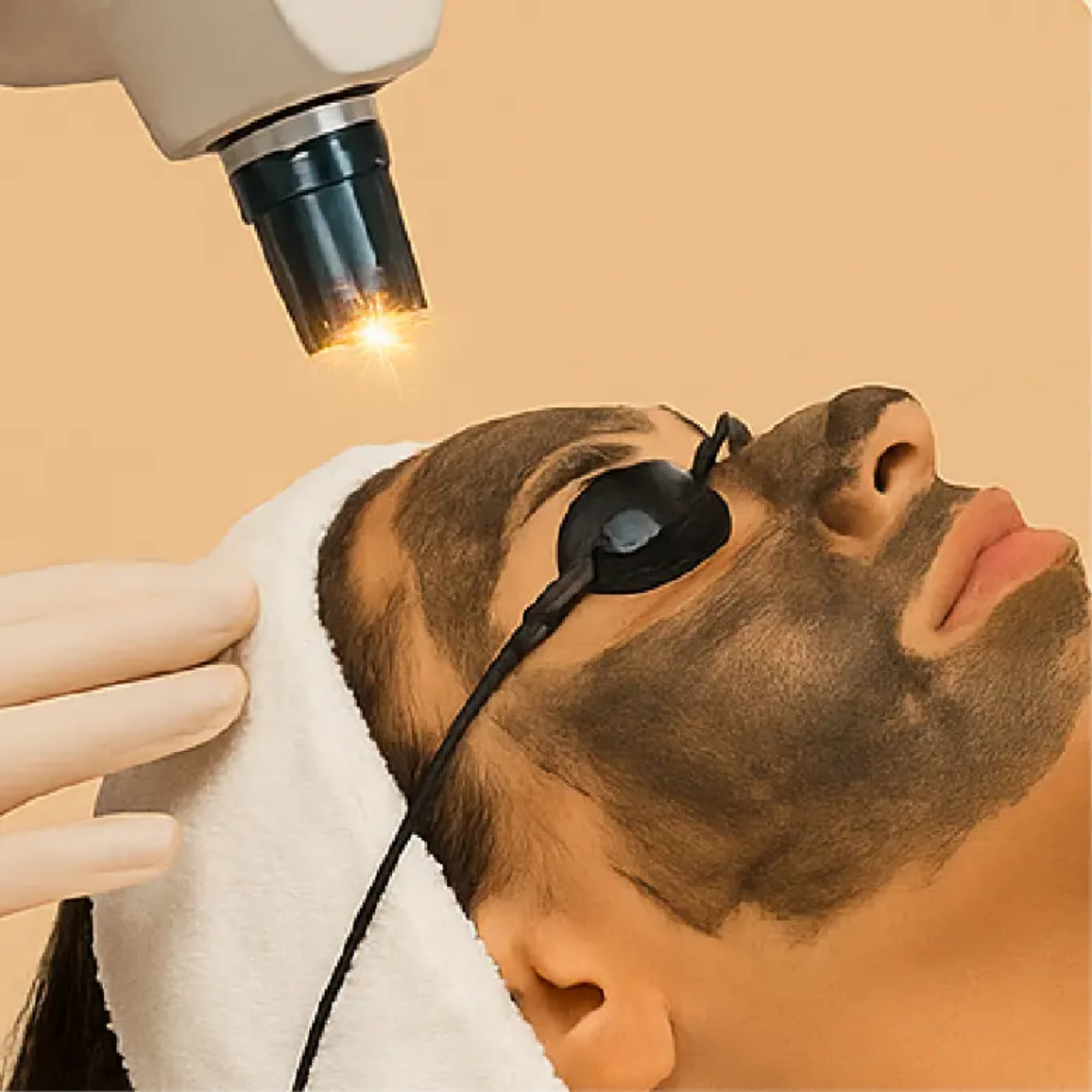 Carbon Laser Treatment + FREE TransGlow Facial - Amoraline