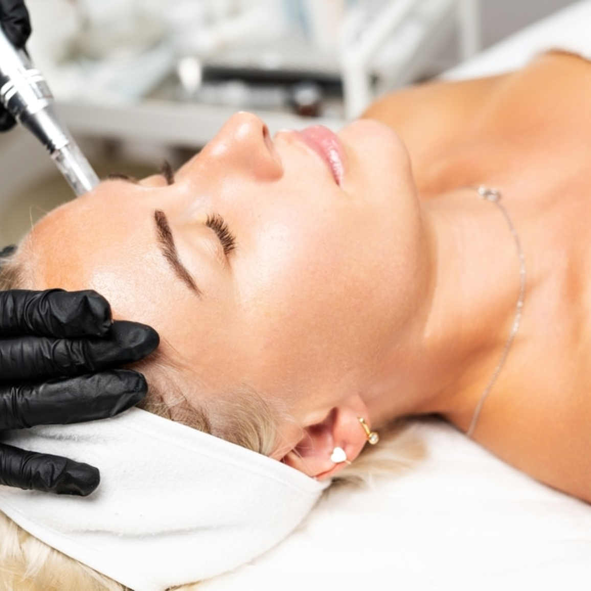 PRP with Serum + Free Microneedling - Amoraline